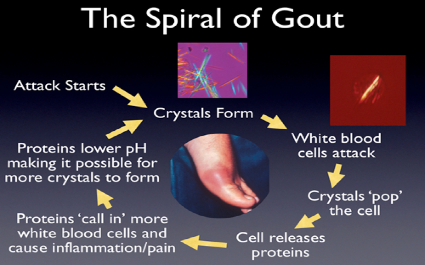 all about gout